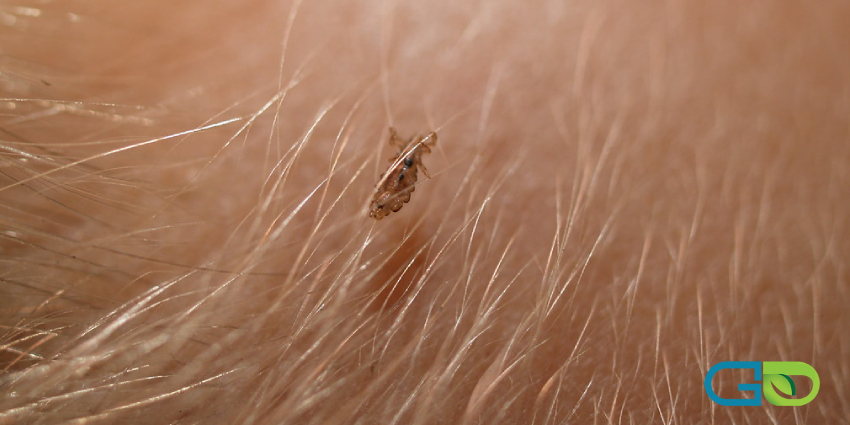 درمان شپش؛ بهترین راه‌های جلوگیری در دانش‌آموزان در مدارس